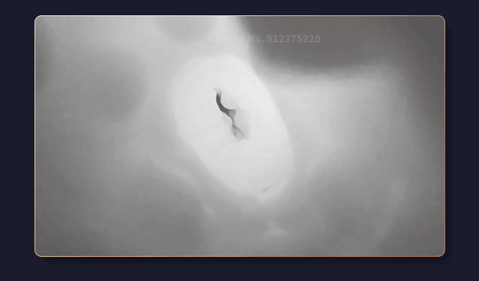 Âm đạo giả Fanle Aix Cup rung bú hút co bóp mạnh mềm mại