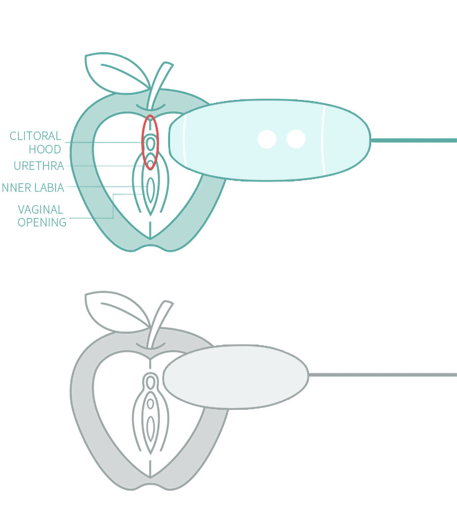 Trứng Nhảy 2 cục rung hút âm đạo Kis Toy Miss USA cao cấp