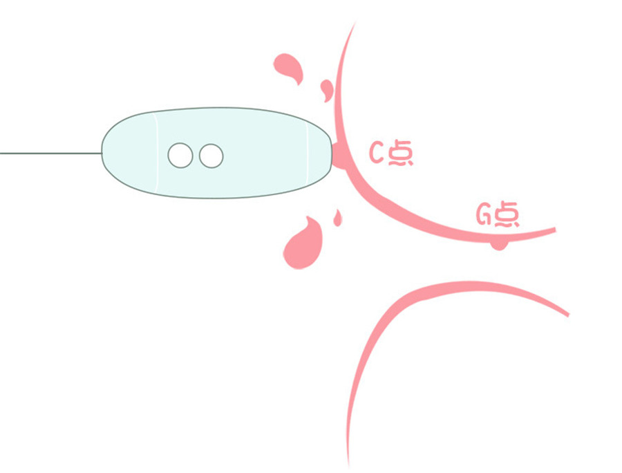 Trứng Nhảy 2 cục rung hút âm đạo Kis Toy Miss USA cao cấp