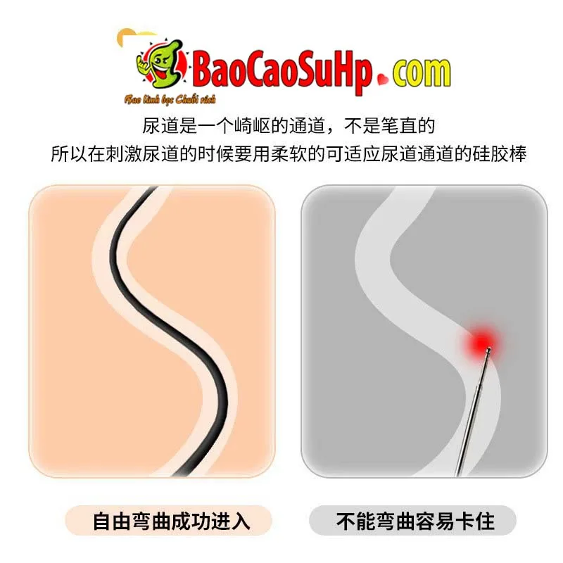 Thụt niệu đạo Simple Roselex Black - ảnh bìa - ảnh 2