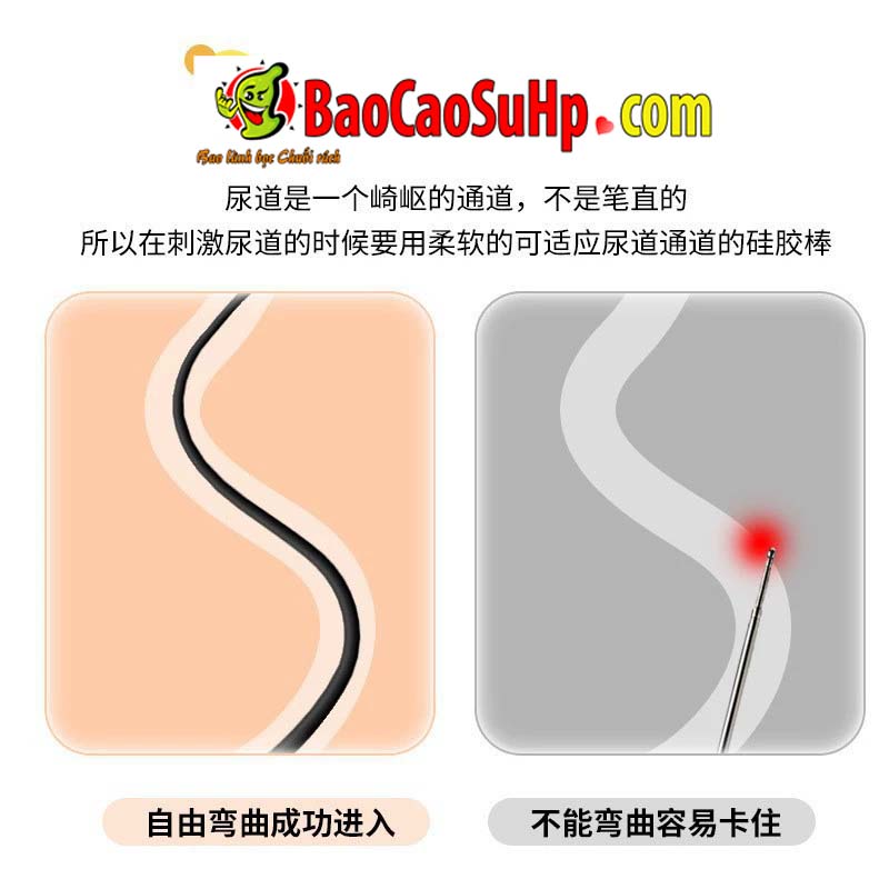 Thụt niệu đạo Simple Roselex Black - ảnh bìa - ảnh 2