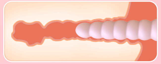 Máy massage hậu môn Seniuniu Prostate xoắn kích thích đỉnh cao